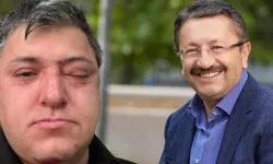 Altındağ Belediyesi personelinin darbedilmesine ilişkin soruşturmada zabıta müdürü tutuklandı!