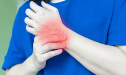 Romatoid Artrit (İltihaplı Romatizma): Nedir, Belirtileri ve Tedavi Yöntemleri